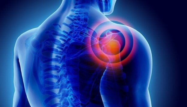 Shoulder Instability Treatment and What to Expect